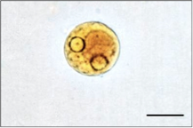 E. histolytica cyst 2