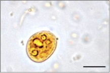 E. histolytica cyst 3 (mature)